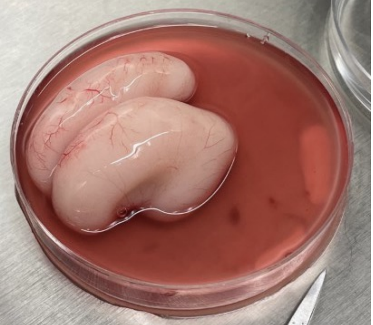 Fetal Brain Development