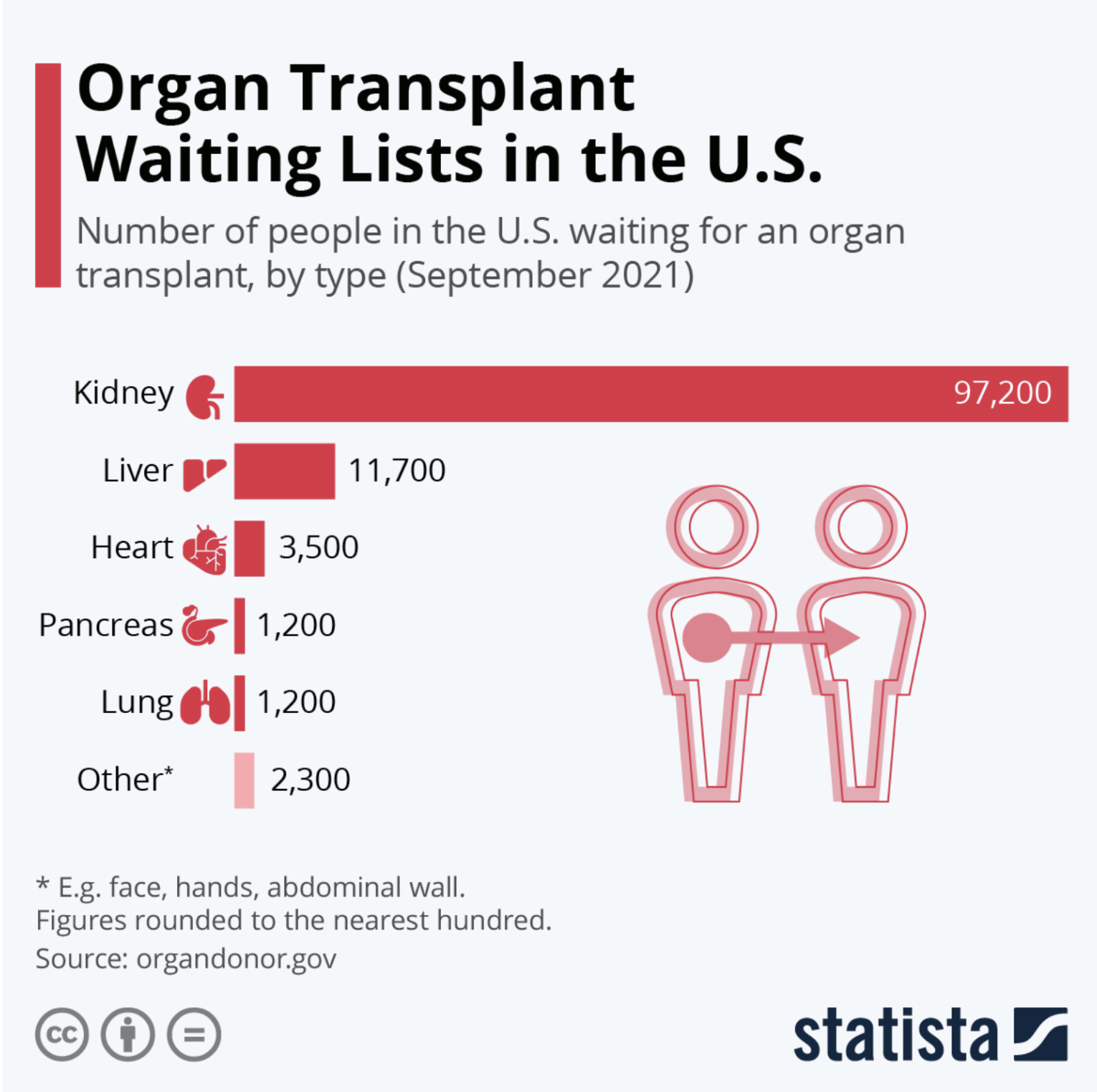 Organ Waiting Times